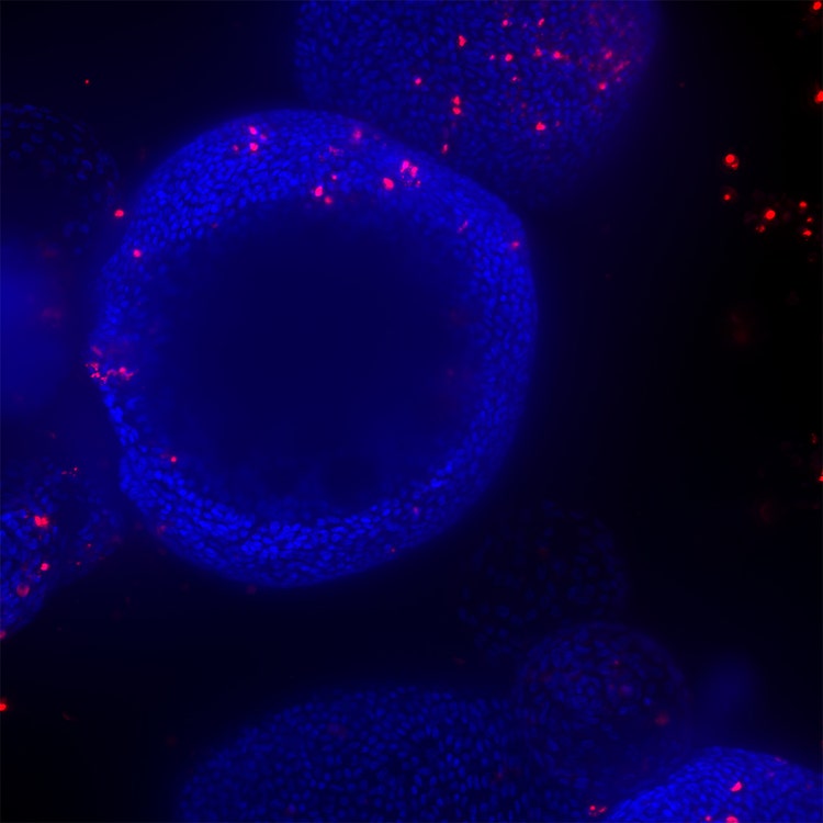 Organoide con agujero negro de HT.ai