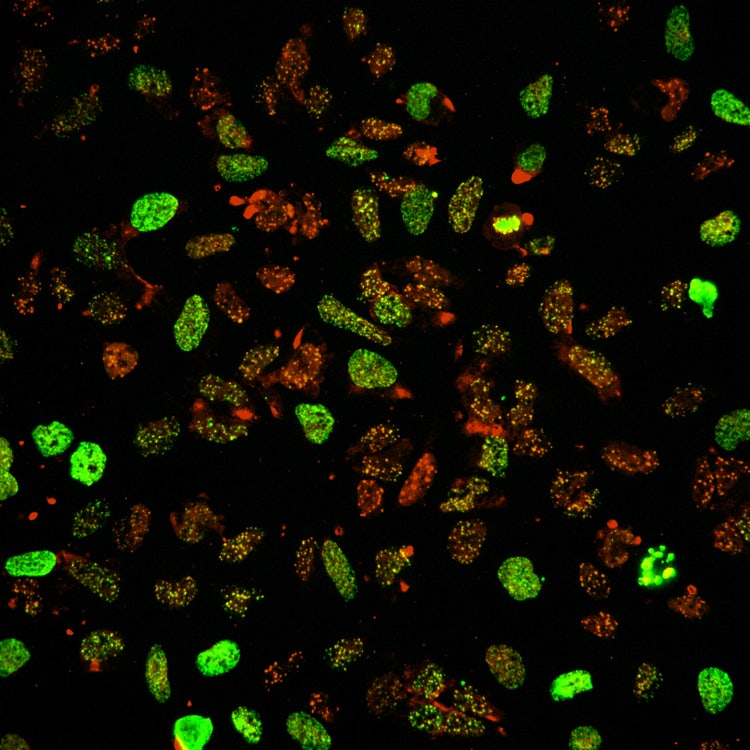 Solución de adquisición de imágenes de alto contenido Micro Confocal