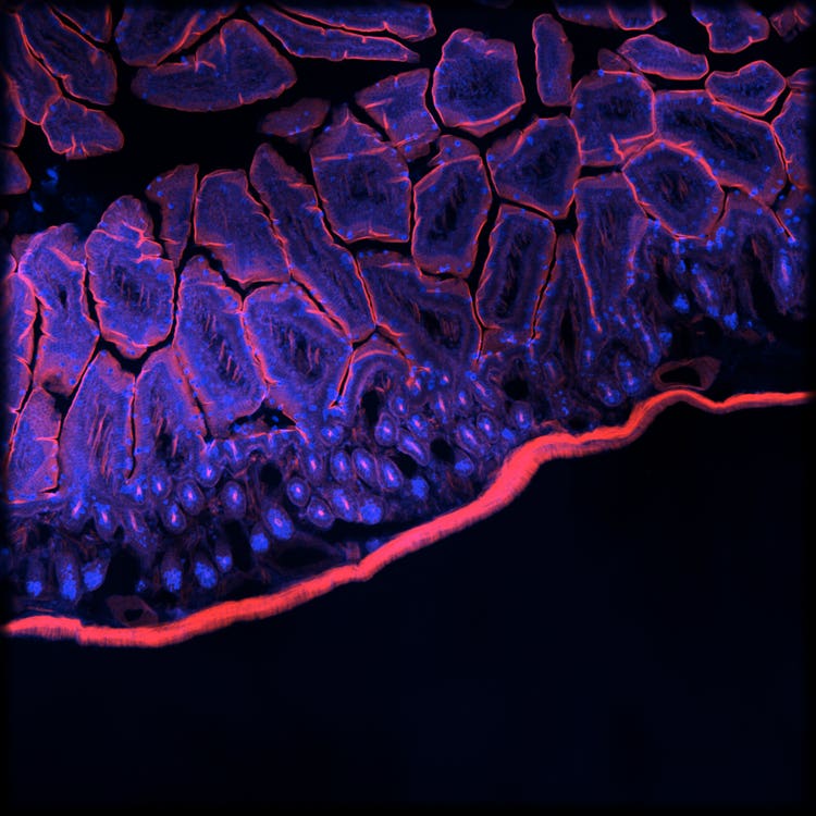 Sistema de adquisición de imágenes Micro Confocal