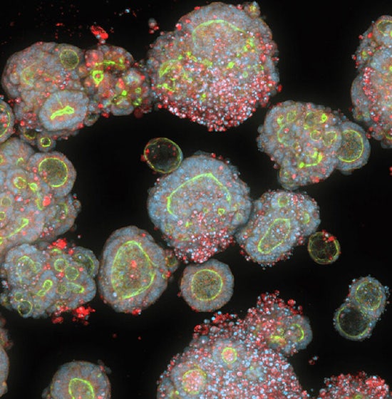 Modelos humanos in vitro