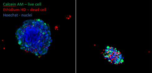 Órganos de cáncer colorrectal