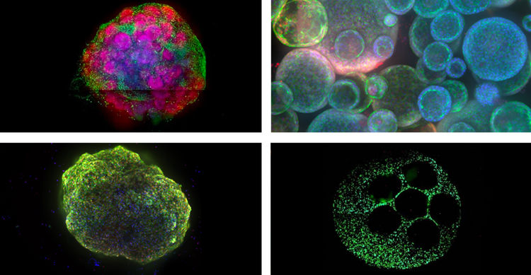 Ejemplos de modelos celulares 3D de la parte superior izquierda: organoides cerebrales, organoides pulmonares, cardioide (organoides cardíacos) y modelo hepático 3D.