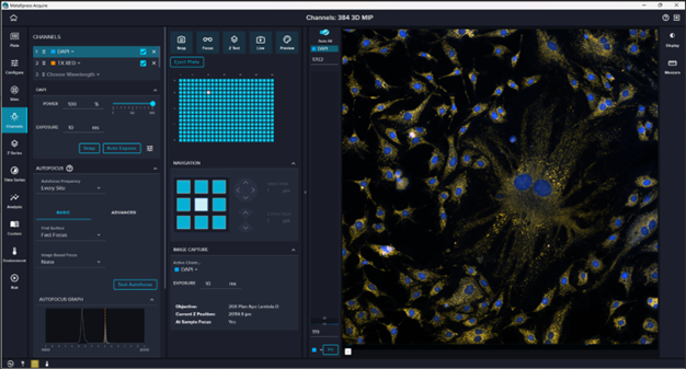 the upgraded MetaXpress Acquire Software streamlines complex workflows