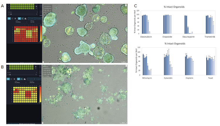 AI-enabled hit selection of drug screening on human pancreatic cancer organoids