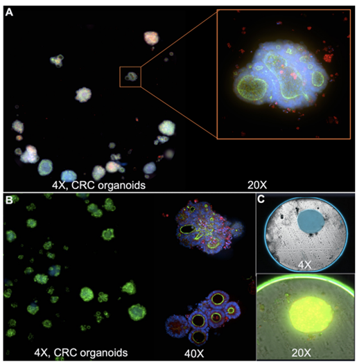 Colorectal Cancer Organoid images originating from AI-analysis tools to improve 3D screening