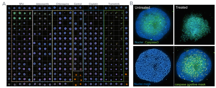 Spheroids imaged on ImageXpress HCS.ai System as viewed in IN Carta Software