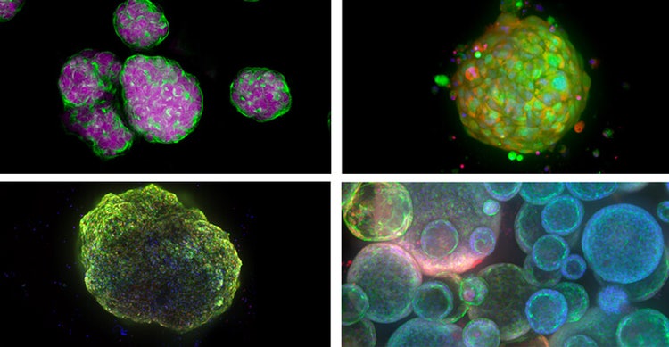 Ejemplos de modelos de células 3D: esferoides, organoides derivados de pacientes, cardioides (orgánicos del corazón) y organoides de los pulmones
