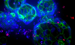 Expansión de organoides 3D Ready: produzca PDO fiables y predictivos a escala