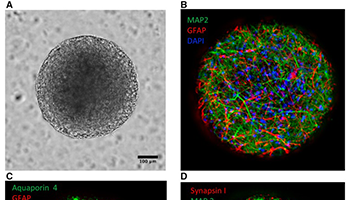 Human IPSC-Derived Neural 3D Cultures