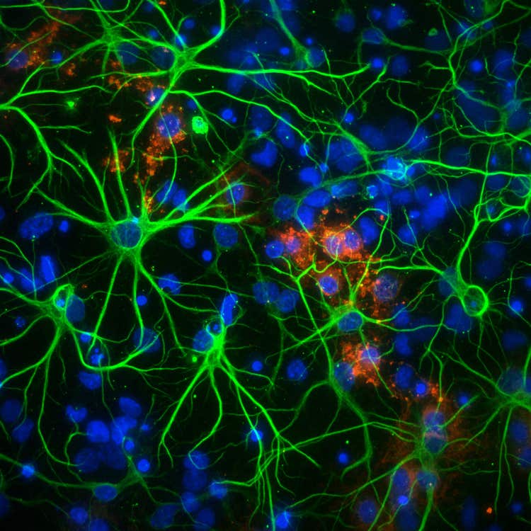 Sistema de adquisición de imágenes de alto contenido Micro Confocal