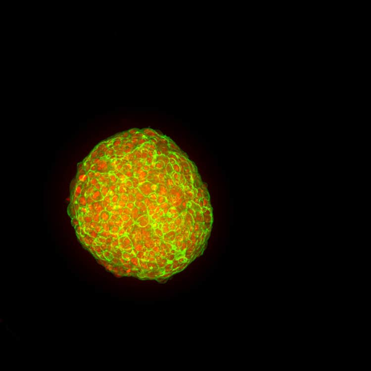 Organoide con superposición de pasos z en HT.ai
