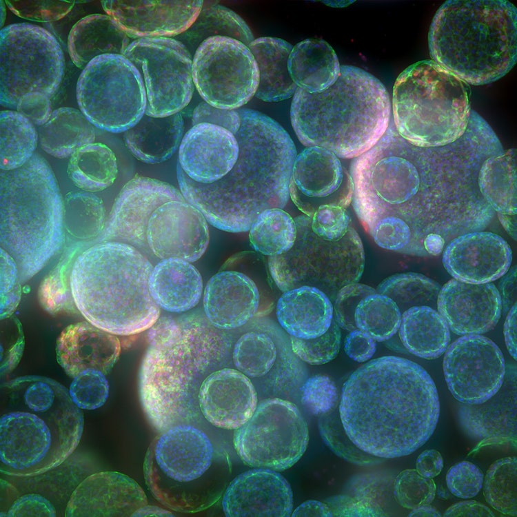 Organoide codificado en HT.ai