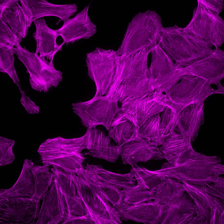 Organoide en HT.ai