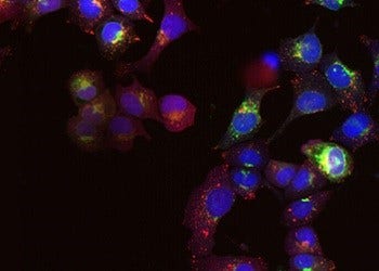 Solución para investigación del cáncer