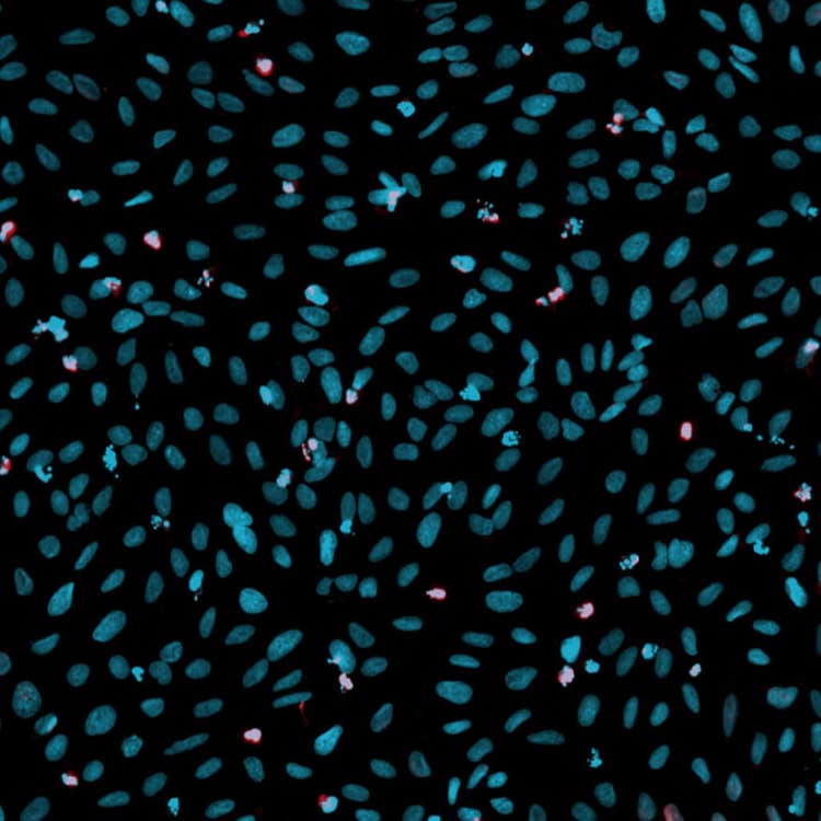 Solapamiento de daño en el ADN en células U2OS con el sistema ImageXpress Nano