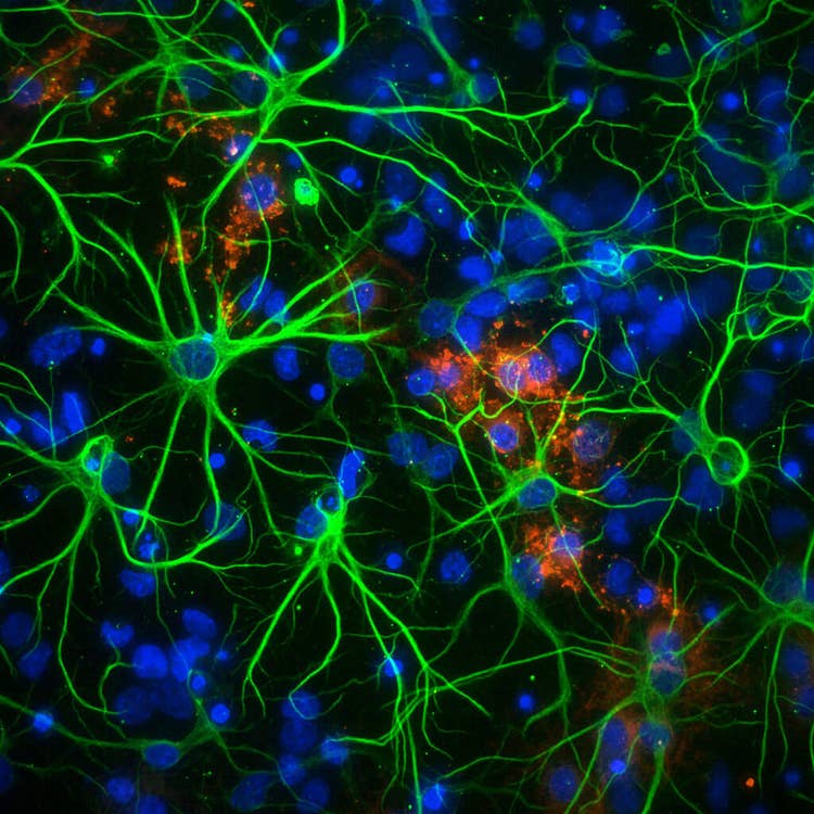 Neuronas en placa de 1536 pocillos a 60x PA con el sistema ImageXpress Micro Confocal