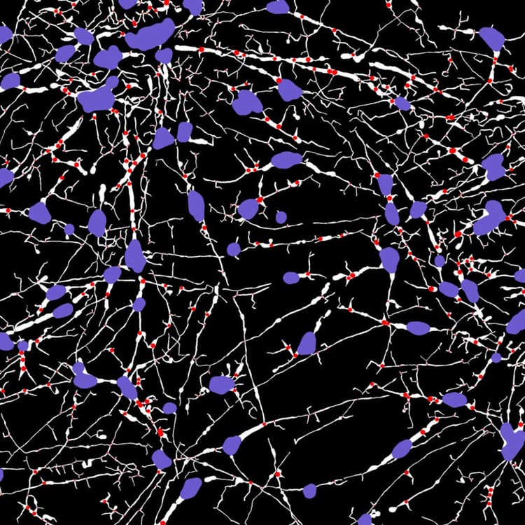 Máscara de crecimiento axonal, imágenes unidas a 40x con el sistema ImageXpress Nano
