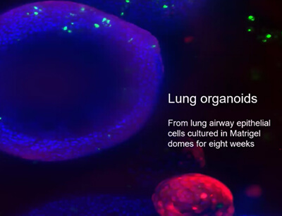 Automated Culture and High-Content Imaging of 3D Lung and Cardiac Organoids