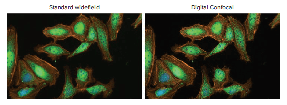 Standard Widefield and Digital Confocal Images