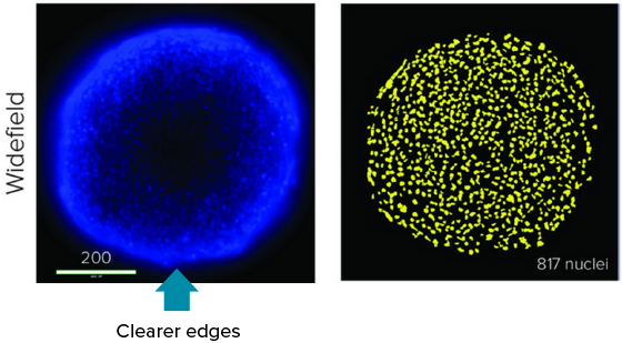 Imagen confocal