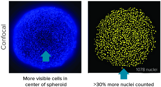 Imagen confocal