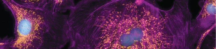 Opción confocal digital
