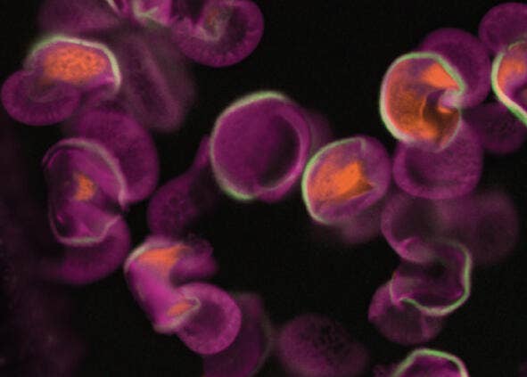 Sin confocal digital