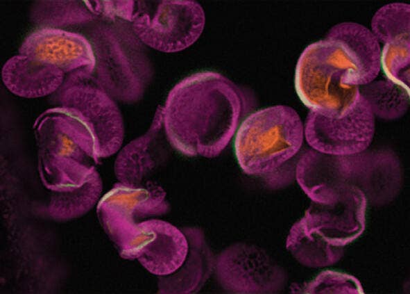 con confocal digital