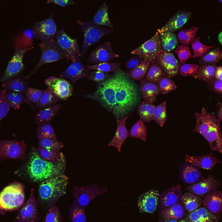 Investigación con células cancerosas